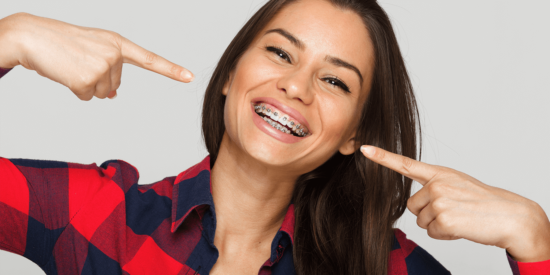 Aparelhos fixos dentários: como ter um Sorriso TOP?